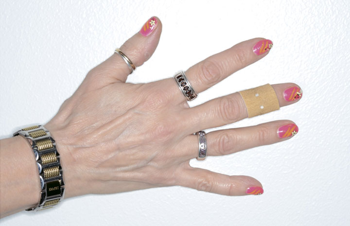 Рис 1. Раны и украшения на руках повышают гигиенический риск (фото: Эса Пиенмунне)